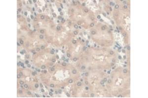 Detection of AR in Rat Kidney Tissue using Monoclonal Antibody to Androgen Receptor (AR) (Androgen Receptor anticorps  (AA 491-679))