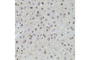 Immunohistochemistry of paraffin-embedded mouse liver using PLK4 antibody (ABIN6003595) at dilution of 1/100 (40x lens). (PLK4 anticorps)