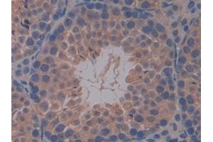 Detection of MMP7 in Mouse Testis Tissue using Polyclonal Antibody to Matrix Metalloproteinase 7 (MMP7)