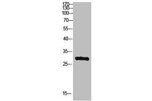 Western Blot analysis of hepg2 cells using Antibody diluted at 500. (MYOZ2 anticorps  (AA 21-70))