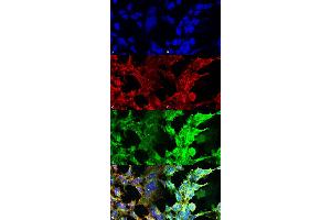 Immunocytochemistry/Immunofluorescence analysis using Mouse Anti-Methylglyoxal Monoclonal Antibody, Clone 9F11 . (Methylglyoxal (MG) anticorps (Atto 594))