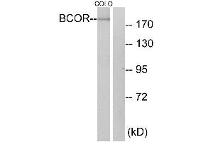 Immunohistochemistry analysis of paraffin-embedded human breast carcinoma tissue using BCOR antibody.