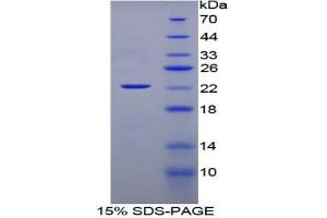 SDS-PAGE analysis of Rat Interferon alpha Protein.