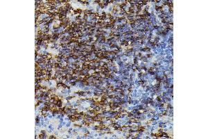 Immunohistochemistry of paraffin-embedded mouse spleen using Apolipoprotein C3 antibody (ABIN7265641) at dilution of 1:100 (40x lens).