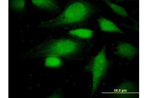 Immunofluorescence of monoclonal antibody to ATE1 on HeLa cell.