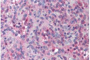Human Spleen (formalin-fixed, paraffin-embedded) stained with XAF1 antibody ABIN214019 at 10 ug/ml followed by biotinylated goat anti-rabbit IgG secondary antibody ABIN481713, alkaline phosphatase-streptavidin and chromogen. (XAF1 anticorps)