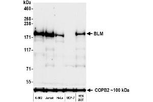 Western Blotting (WB) image for anti-Bloom Syndrome RecQ Like Helicase (BLM) (C-Term) antibody (ABIN7795725) (Recombinant BLM anticorps  (C-Term))