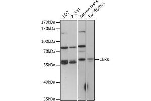 Western blot analysis of extracts of various cell lines, using CERK antibody (ABIN7266282) at 1:1000 dilution. (CERK anticorps  (C-Term))