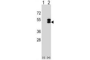 Western blot analysis of ATXN3 (arrow) using rabbit polyclonal ATXN3 Antibody (Center) .