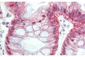 Detection of MTF1 in Human Colon Tissue using Polyclonal Antibody to Metal Regulatory Transcription Factor 1 (MTF1) (MTF1 anticorps  (AA 2-139))
