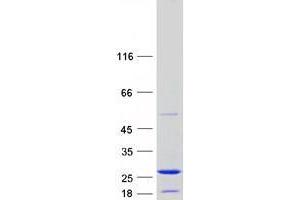Validation with Western Blot