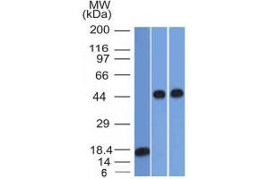 Western Blot Analysis of 1) recombinant Alpha-1-Antitrypsin 2) Jurkat & 3) A549 cell lysate using Alpha-1-Antitrypsin Mouse Monoclonal Antibody (AAT/1378). (SERPINA1 anticorps)