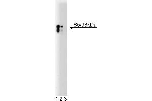Western Blotting (WB) image for anti-Huntingtin Associated Protein 1 (HAP1) (AA 100-289) antibody (ABIN968461)