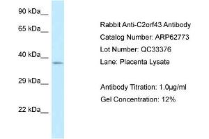 Western Blotting (WB) image for anti-Lipid Droplet-Associated Hydrolase (LDAH) (C-Term) antibody (ABIN2789241) (LDAH/C2orf43 anticorps  (C-Term))