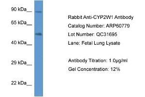 Western Blotting (WB) image for anti-Cytochrome P450, Family 2, Subfamily W, Polypeptide 1 (CYP2W1) (C-Term) antibody (ABIN786271) (CYP2W1 anticorps  (C-Term))