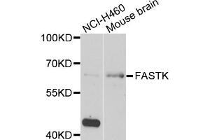 Western blot analysis of extracts of various cell lines, using FASTK antibody (ABIN5974251) at 1/1000 dilution. (FASTK anticorps)