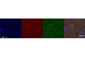 Immunohistochemistry (IHC) image for anti-serpin Peptidase Inhibitor, Clade F (Alpha-2 Antiplasmin, Pigment Epithelium Derived Factor), Member 1 (SERPINF1) antibody (ABIN7456107)