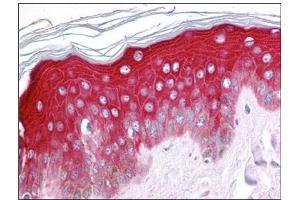 Human Skin: Formalin-Fixed, Paraffin-Embedded (FFPE)