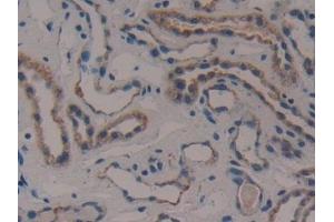 Detection of CS in Human Kidney Tissue using Polyclonal Antibody to Citrate Synthase (CS)