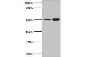 Western blot All lanes: Polycomb protein EED antibody at 4 μg/mL Lane 1: Hela whole cell lysate Lane 2: K562 whole cell lysate Secondary Goat polyclonal to rabbit IgG at 1/10000 dilution Predicted band size: 51, 54, 46 kDa Observed band size: 51 kDa (EED anticorps  (AA 1-300))