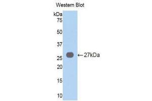 Western Blotting (WB) image for anti-Vav 3 Oncogene (VAV3) (AA 183-380) antibody (ABIN3203801) (VAV3 anticorps  (AA 183-380))