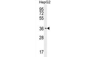 Western Blotting (WB) image for anti-CCR4-NOT Transcription Complex, Subunit 8 (CNOT8) antibody (ABIN2996023) (CNOT8 anticorps)