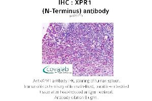 Image no. 1 for anti-Xenotropic and Polytropic Retrovirus Receptor 1 (xpr1) antibody (ABIN1740878) (xpr1 anticorps)