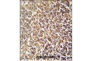 ZNF98 antibody (C-term) (ABIN654480 and ABIN2844215) immunohistochemistry analysis in formalin fixed and paraffin embedded human lymphnode followed by peroxidase conjugation of the secondary antibody and DAB staining. (ZNF98 anticorps  (C-Term))