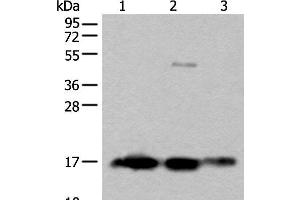 Western blot analysis of Rat brain tissue Human cerebrum tissue Human cerebella tissue lysates using SNCB Polyclonal Antibody at dilution of 1:450 (beta Synuclein anticorps)