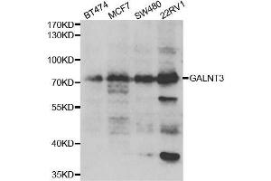Western blot analysis of extracts of various cell lines, using GALNT3 antibody. (GALNT3 anticorps  (AA 1-140))
