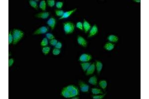 Immunofluorescence staining of Hela cells with ABIN7168857 at 1:133, counter-stained with DAPI. (Septin 11 anticorps  (AA 237-429))