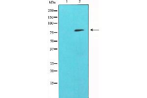 Western blot analysis of SYK expression in whole cell lysates,The lane on the left is treated with the antigen-specific peptide. (SYK anticorps)