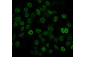 IF analysis of hnRNP D/AUF1/HNRNPD using anti-hnRNP D/AUF1/HNRNPD antibody (ABIN7602592). (HNRNPD/AUF1 anticorps  (AA 88-246))