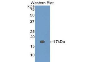 Western Blotting (WB) image for anti-Dymeclin (DYM) (AA 546-669) antibody (ABIN1111113) (Dymeclin anticorps  (AA 546-669))