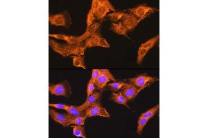 Immunofluorescence analysis of L929 cells using CDV3 Rabbit pAb (ABIN7266240) at dilution of 1:100. (CDV3 anticorps)