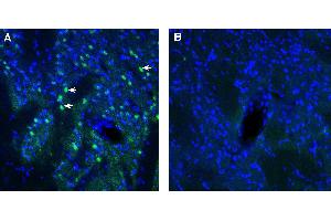 Expression of ADAM23 in rat striatum. (Adam23 anticorps  (Extracellular))