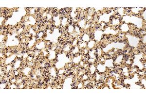 Detection of C3a in Rat Lung Tissue using Polyclonal Antibody to Complement Component 3a (C3a) (C3a anticorps  (AA 671-748))