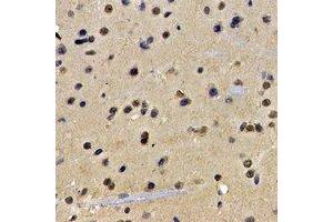 Immunohistochemical analysis of ATIC staining in rat brain formalin fixed paraffin embedded tissue section.