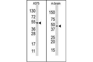 Image no. 1 for anti-Hypoxia Inducible Factor 1, alpha Subunit Inhibitor (HIF1AN) (C-Term) antibody (ABIN356560) (HIF1AN anticorps  (C-Term))