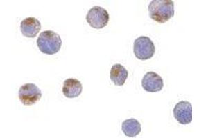 anti-Complement C1q Tumor Necrosis Factor-Related Protein 6 (C1QTNF6) (C-Term) antibody