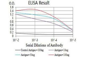 Black line: Control Antigen (100 ng),Purple line: Antigen (10 ng), Blue line: Antigen (50 ng), Red line:Antigen (100 ng) (P2RY8 anticorps)