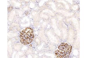 Immunohistochemistry analysis of paraffin-embedded human kidney using NES Monoclonal Antibody at dilution of 1:400.