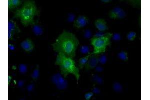 Image no. 5 for anti-Basigin (Ok Blood Group) (BSG) antibody (ABIN1498013) (CD147 anticorps)