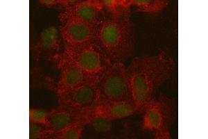 IF analysis of ARID1A using anti-ARID1A antibody (ABIN7602567) and anti-Beta Tubulin antibody (ABIN7602743). (ARID1A anticorps  (AA 857-1552))