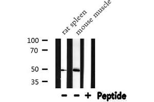 Western blot analysis of IL13RA2 expression in various lysates (IL13RA2 anticorps  (C-Term))