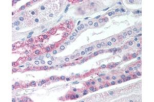 Anti-TGR5 antibody IHC of human kidney.