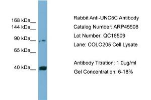 WB Suggested Anti-UNC5C  Antibody Titration: 0. (Unc5c anticorps  (Middle Region))