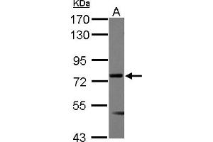 Western Blotting (WB) image for anti-Multiple Endocrine Neoplasia 1 (MEN1) (AA 71-407) antibody (ABIN1499428) (Menin anticorps  (AA 71-407))