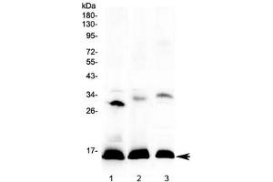 Western blot testing of 1) human placenta, 2) rat spleen and 3) mouse spleen lysate with HBD antibody at 0. (HBd anticorps)