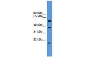 Image no. 1 for anti-serine Peptidase Inhibitor, Kunitz Type, 2 (SPINT2) (AA 91-140) antibody (ABIN6746573)
